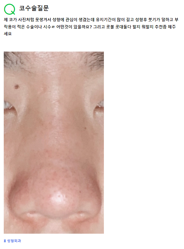 Q. 못생긴코, 코수술 질문 입니다.