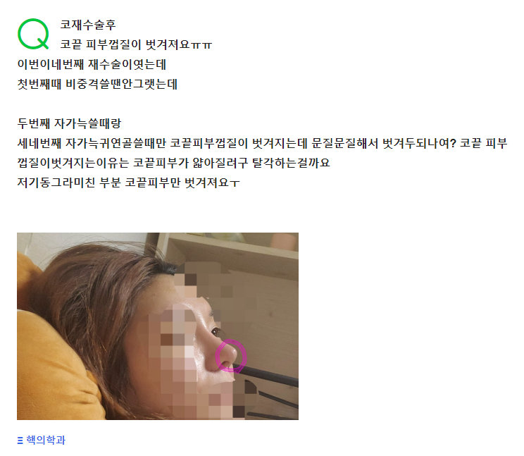 Q. 코재수술로 자가늑을 썼는데 피부껍질이 벗겨져요ㅠㅠ