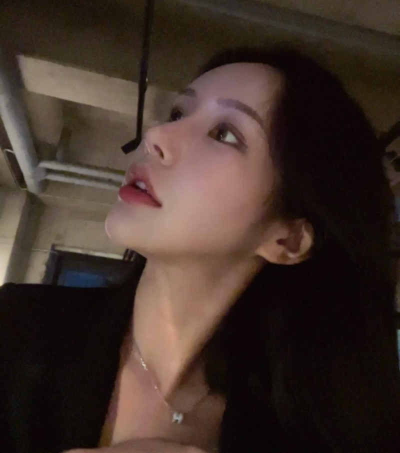 과도하게 화려한코, 귀연골에 비중격코수술로 자연스럽게 개선 됐어요!