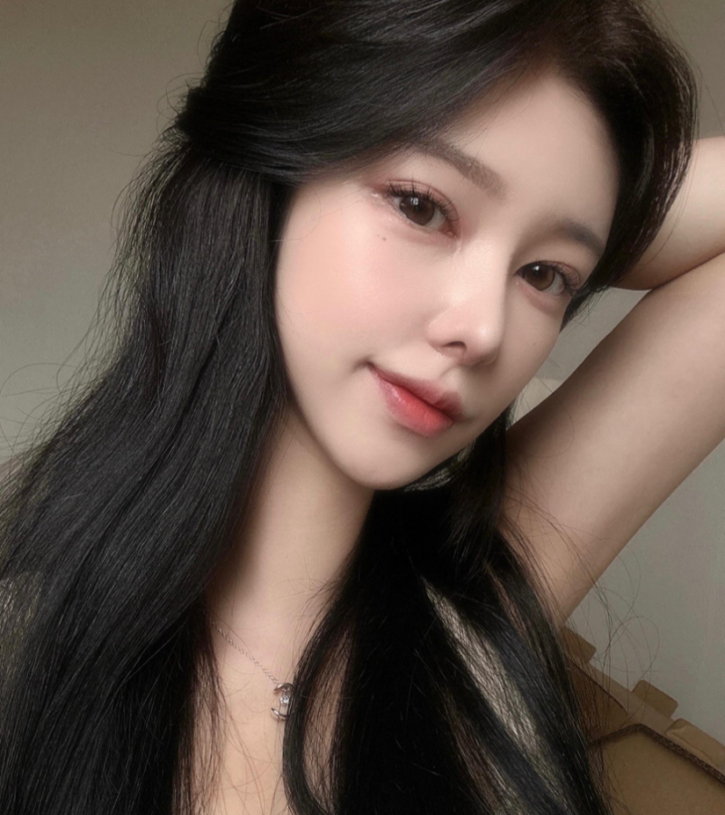비순각수술로 낮은코성형을 성공해 제가 원하는 코모양을 얻었어요! 사진 5