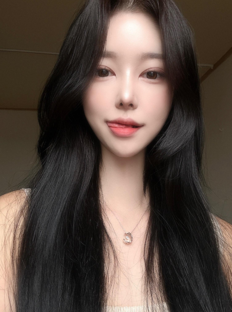 비순각수술로 낮은코성형을 성공해 제가 원하는 코모양을 얻었어요! 사진 4