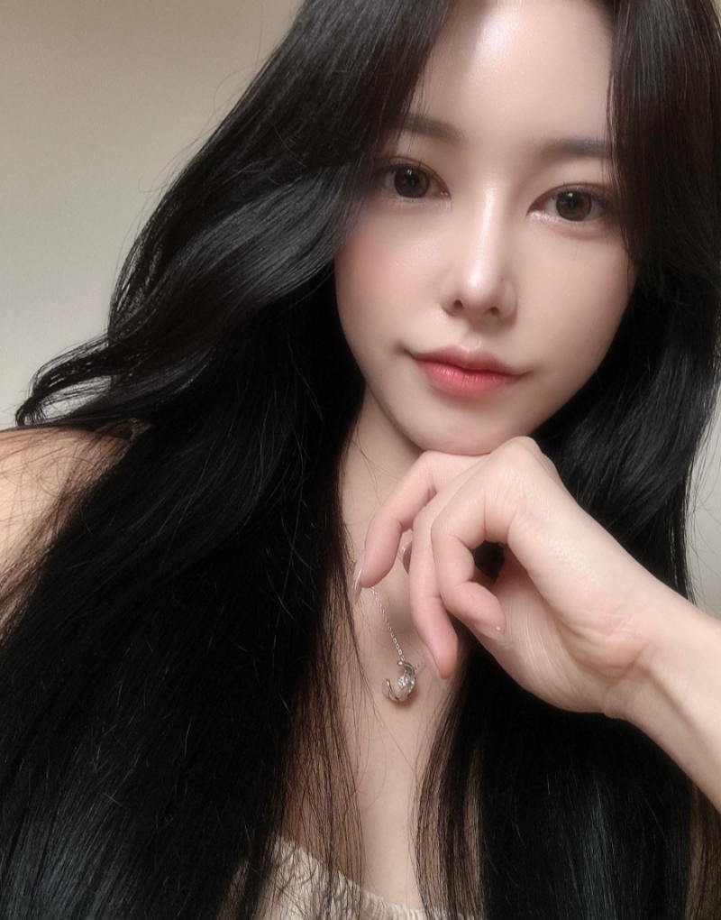 비순각수술로 낮은코성형을 성공해 제가 원하는 코모양을 얻었어요! 사진 6