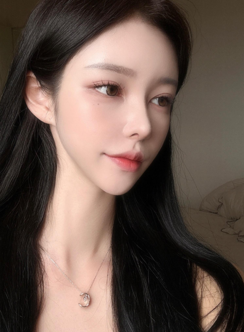 비순각수술로 낮은코성형을 성공해 제가 원하는 코모양을 얻었어요! 사진 3