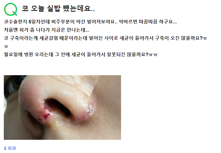 Q. 5일 뒤에 코수술 실밥제거 했는데 구축코 생기진 않겠죠?