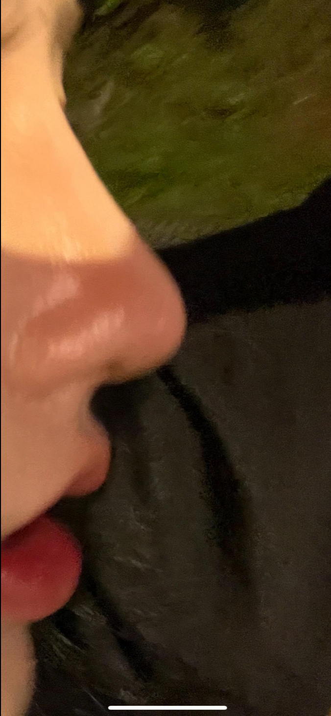 울퉁불퉁해 신경 쓰이던 코를 코원성형외과에서 낮은코와 매부리코교정으로 매끄럽게 만들었어요! 사진 9