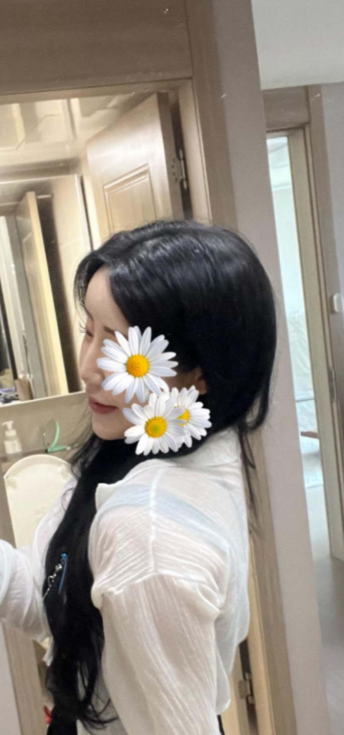 울퉁불퉁해 신경 쓰이던 코를 코원성형외과에서 낮은코와 매부리코교정으로 매끄럽게 만들었어요!