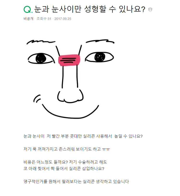 Q. 눈과 눈 사이 콧대 높일 수 있을까요?(비개방코성형으로 미간 높이기) 사진 2