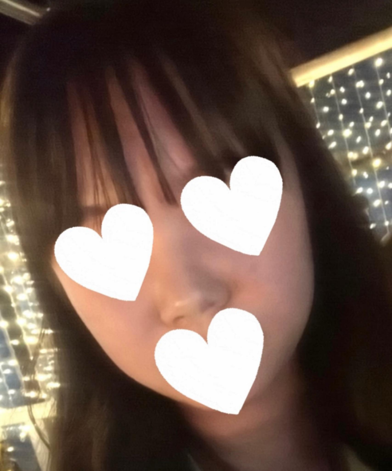 코원성형외과에서 작고 뭉뚝한코 교정과 비중격만곡증 기능코수술로 다시 태어났어요 사진 3