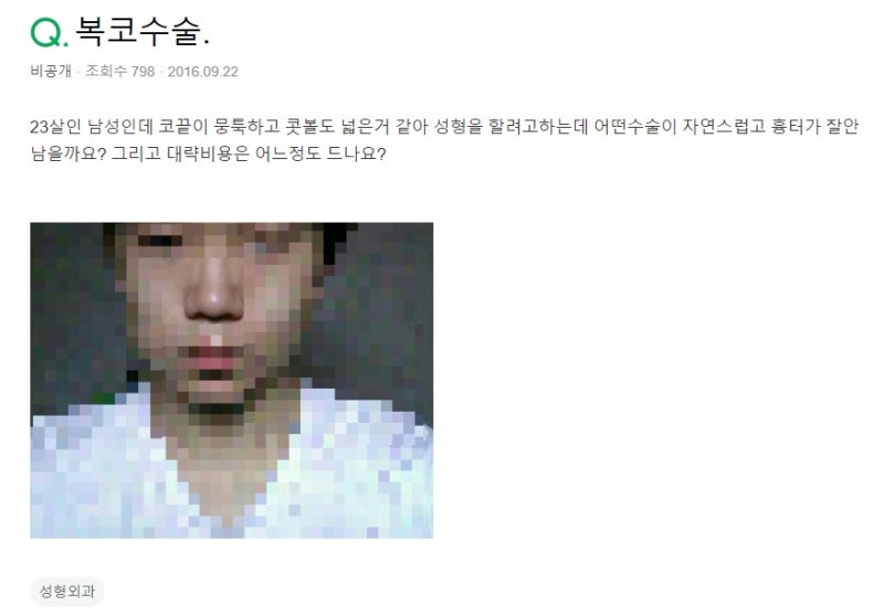 콧볼축소 수술하면 코수술흉터 남나요? feat. 남자복코수술