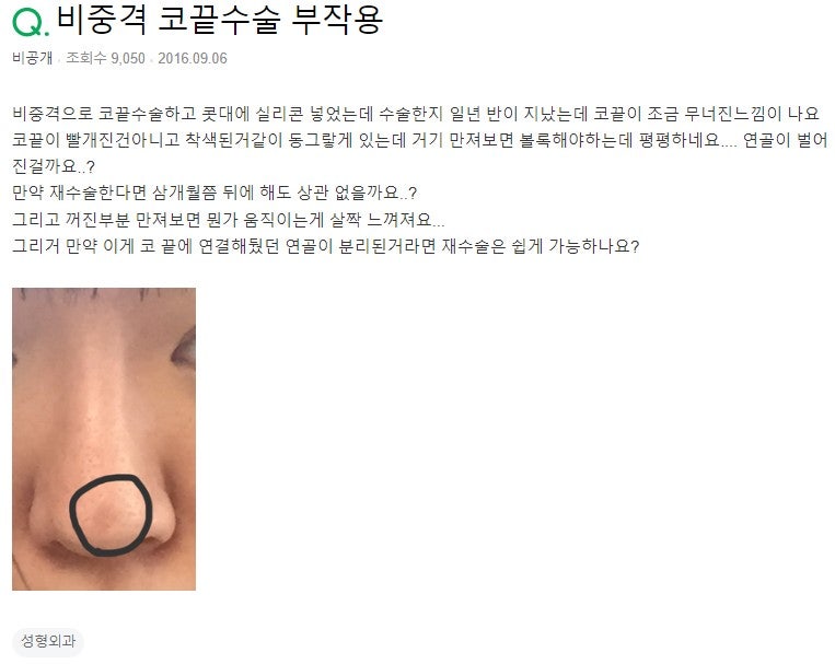 Q. 비중격 코끝수술했는데 코끝수술부작용 의심되네요