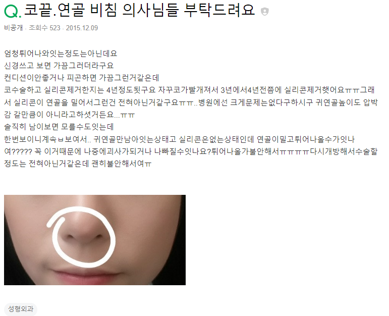 Q. 귀연골로 코 수술, 실리콘 제거 후에도..