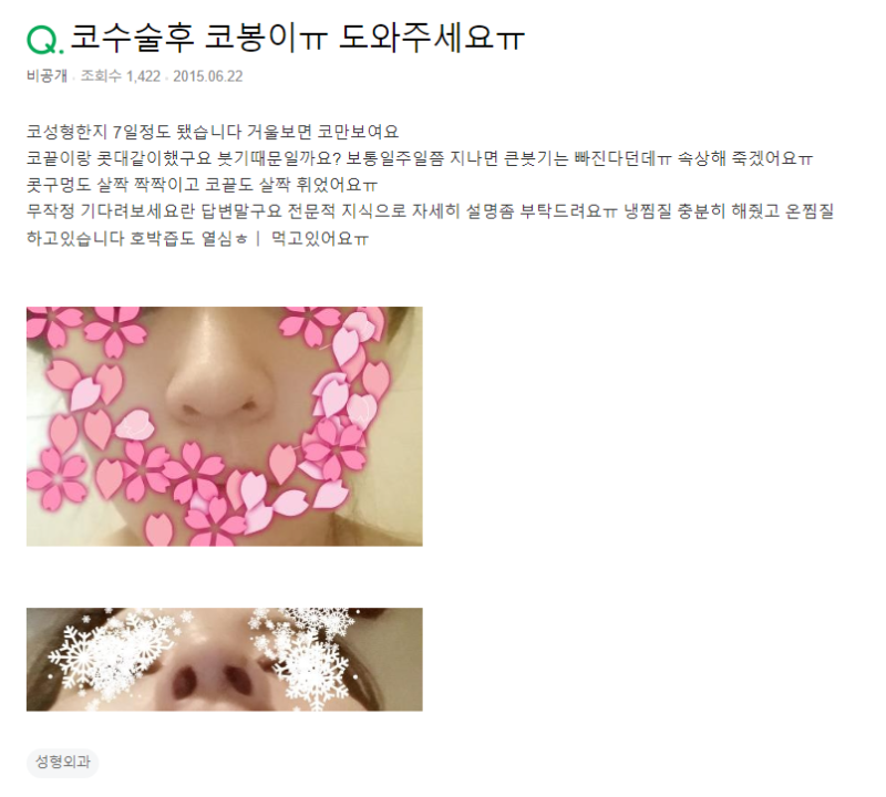 Q. 코붓기 때문에 코봉이로 보이는 거겠죠?