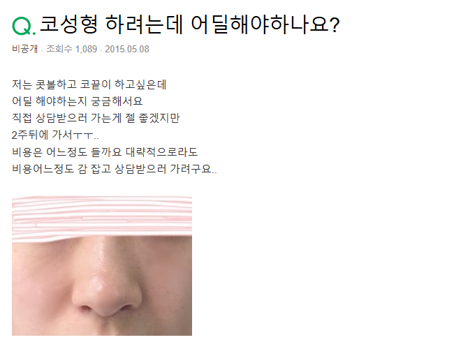 Q. 매부리 코, 비중격으로 개선해야 할까요?