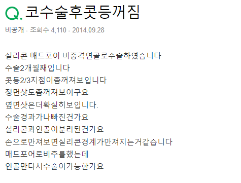 Q. 실리콘 코 수술 후 콧등함몰, 재수술해야 될까?