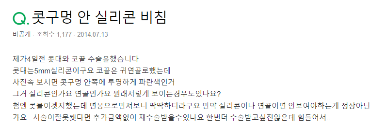 Q. 코안 실리콘 비침? 연골인가요?
