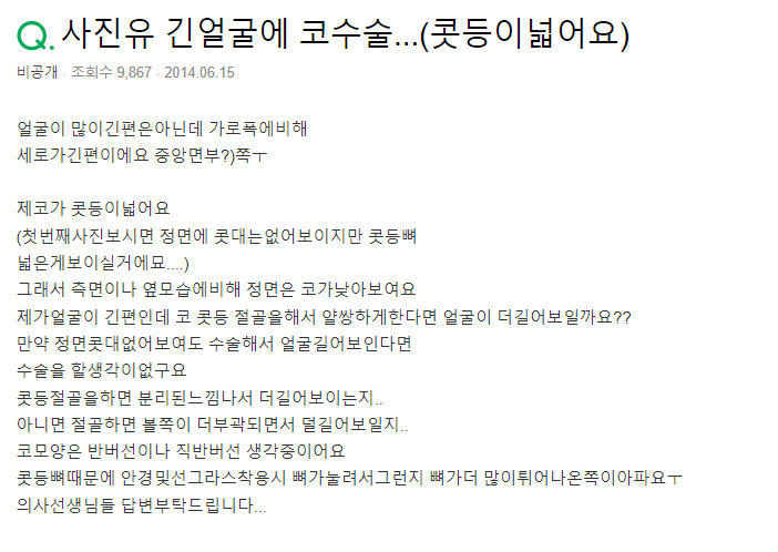 Q. 넓은 콧등뼈 절골술, 얼굴 더 길어 보일까요?