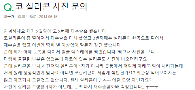 Q. 코재수술 2번, 코실리콘 모양이 이상해요.