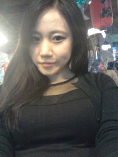 Q. 수술해도 퍼진코 코재수술로 작은코 되고 싶어요 사진 3
