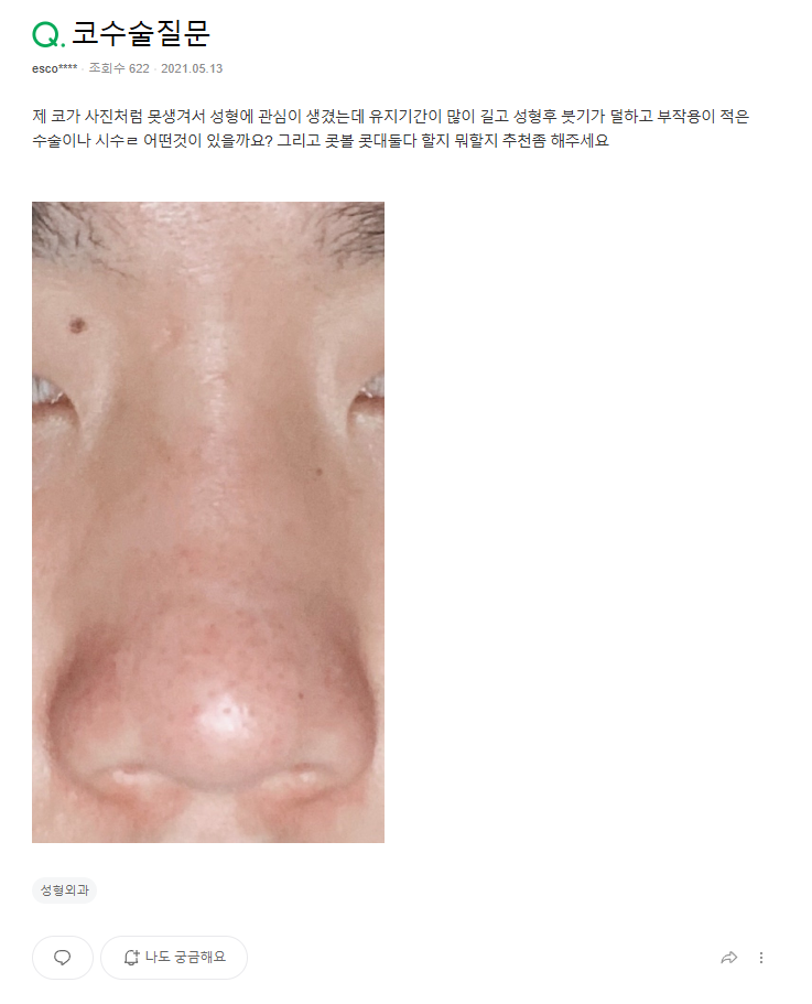 Q. 남자눈코성형 관심있는데 남자 코 성형 외과 어디가 좋을까요? 사진 2