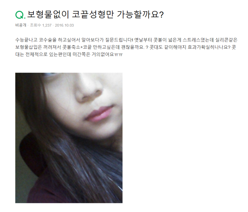 Q. 보형물 없이 콧볼축소수술 전후 변화와 콧볼 축소수술방법 알아보기 사진 2