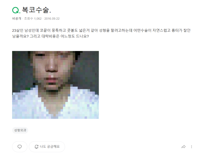 Q. 남자 콧볼축소수술 고민중인데 복코수술전후 결과가 궁금해요 사진 2