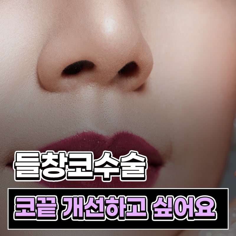 Q. 들창코성형 인공 보형물 없이 콧구멍 개선하고 싶어요