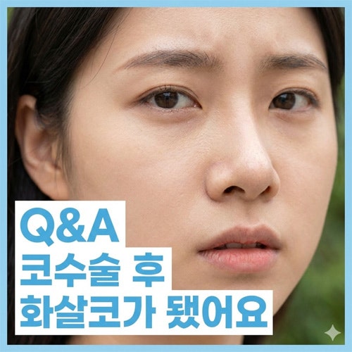 Q. 코수술 후 화살코가 됐어요.. 어떤 방식의 재수술 필요할까요?