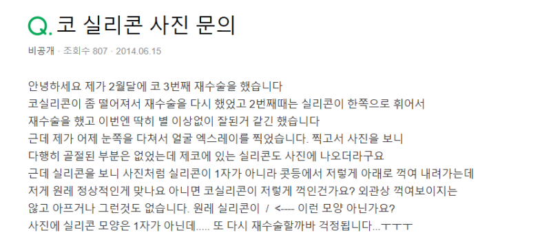 Q. 코수술 실리콘 변화, 재수술이 필요한 경우일까? 사진 2