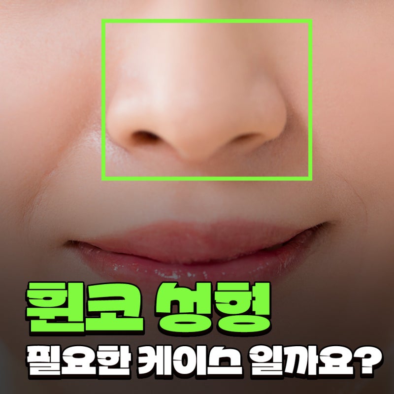 Q. 휜코성형 고민, 양악수술 전 고려해야 할 코수술 방향