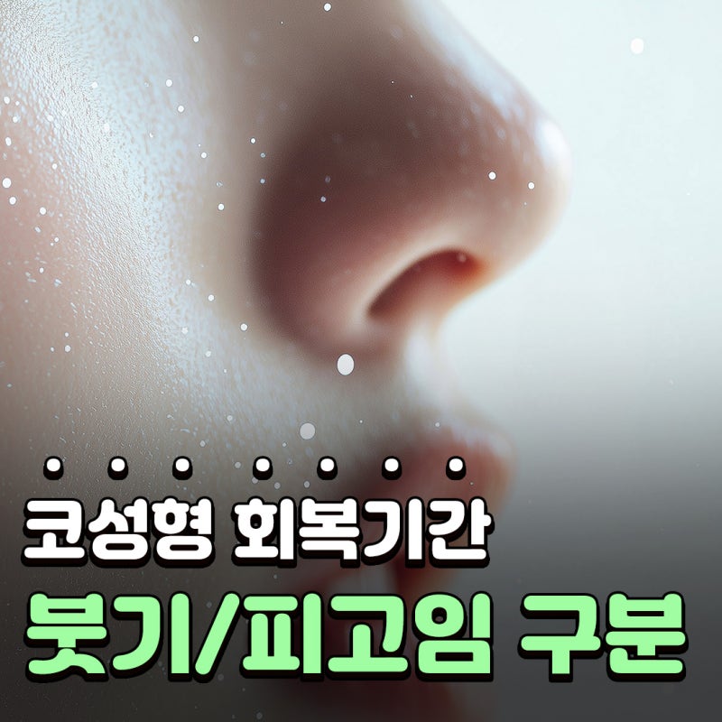 Q. 코성형 회복기간 동안 붓기와 피고임 구분, 콧대재수술 시기 정리