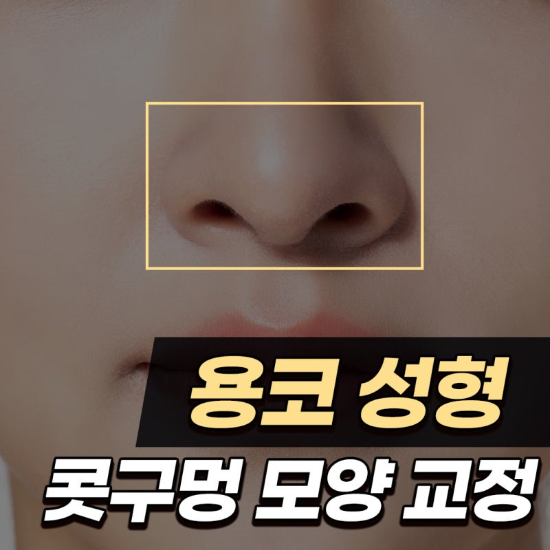 Q. 용코수술 고민, 콧구멍 모양 교정 필요할까?