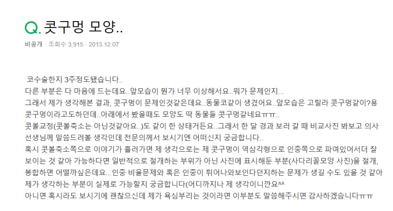 Q. 용코수술 고민, 콧구멍 모양 교정 필요할까?
