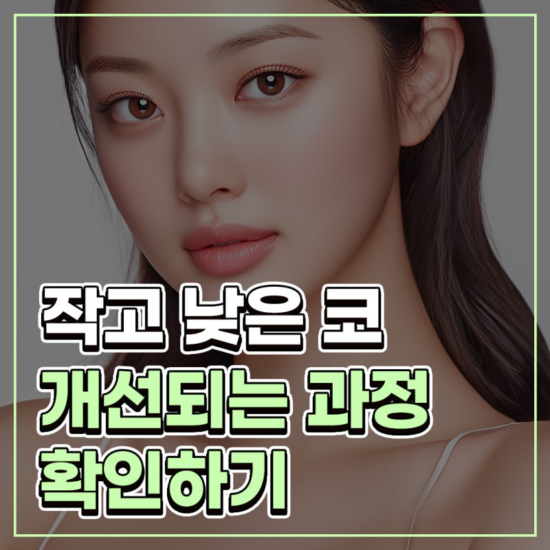 코끝 연골묶기 전후 변화로 보는 자연스러운 코 라인 개선 과정