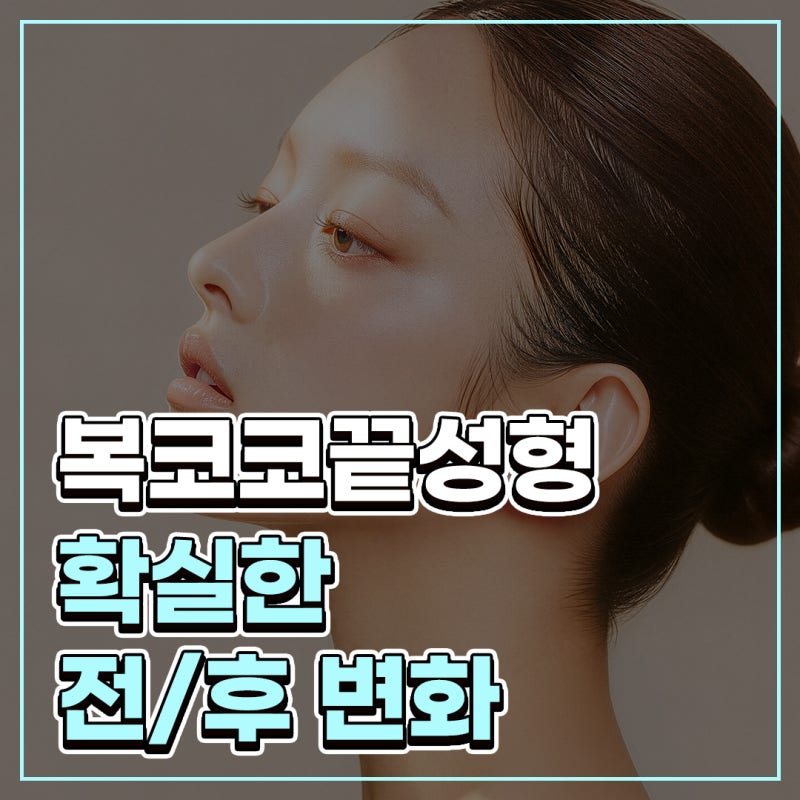 복코코끝성형 전후, 퍼진 코끝과 둔한 콧대 개선 과정 알아봐요