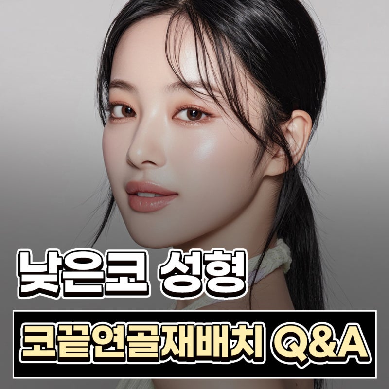 낮은코성형 입체적인 인상으로 변화, 코끝연골재배치 질문 3가지