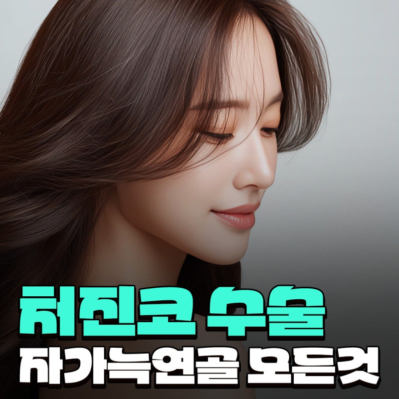 자가늑연골코수술 자연스러울까요? 처진 코끝과 미간 라인까지 정리한 과정