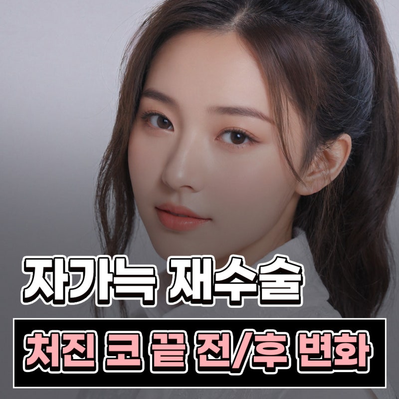 자가늑 코성형으로 코끝 처짐과 구조를 함께 고려해야 하는 이유