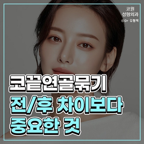 코끝 연골묶기 전후 단순히 모으는 변화보다 중요한 구조적 균형