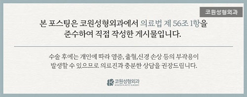 여자매부리코수술 무조건 매끈하게 깎기보다 먼저 볼 라인 기준 사진 5