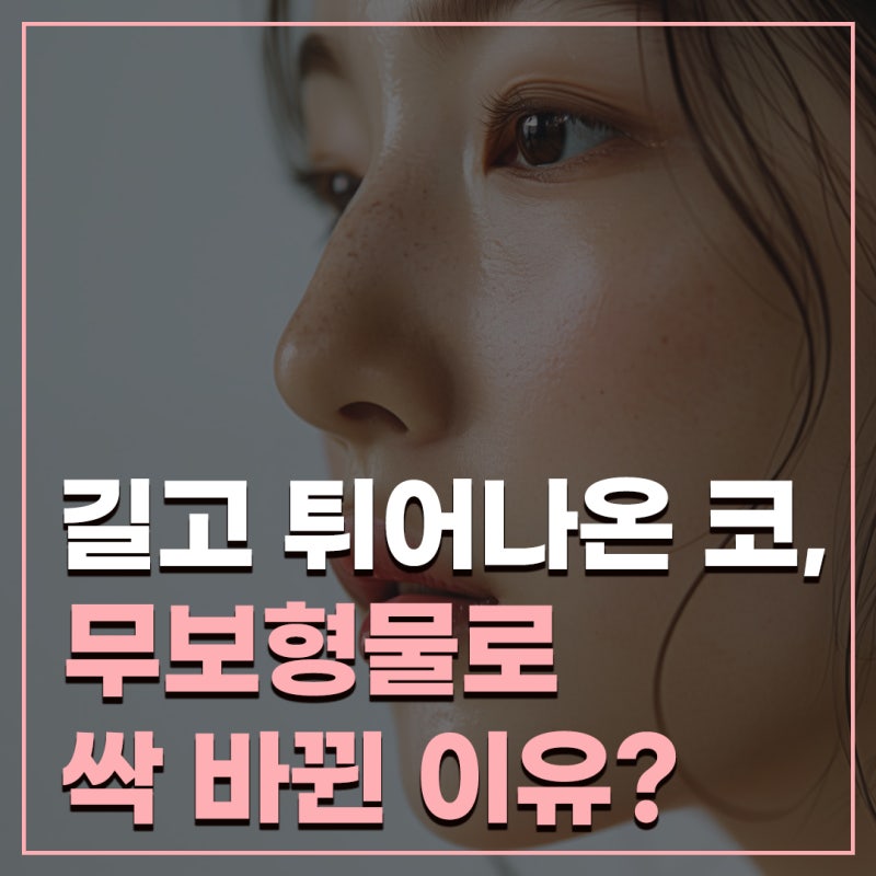 [매부리코 교정] 코원성형외과 무보형물 코수술 직후, 처진 코끝까지 바뀐 실제 사례