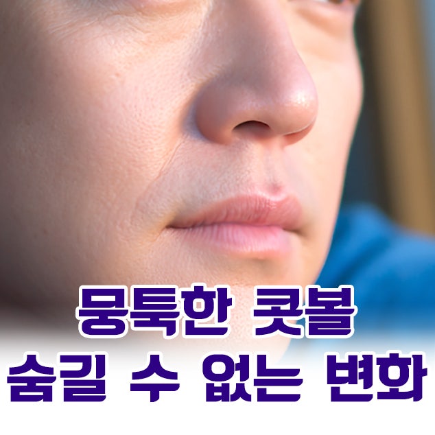 코원성형외과 복코 교정 직후의 변화와 뚱뚱한 코 복코 교정 노하우