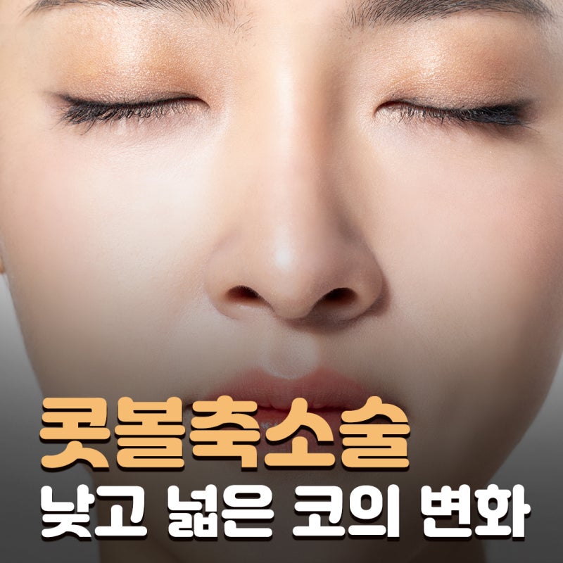 복코 교정, 콧대부터 코끝까지 달라지는 콧볼축소수술전후 모습