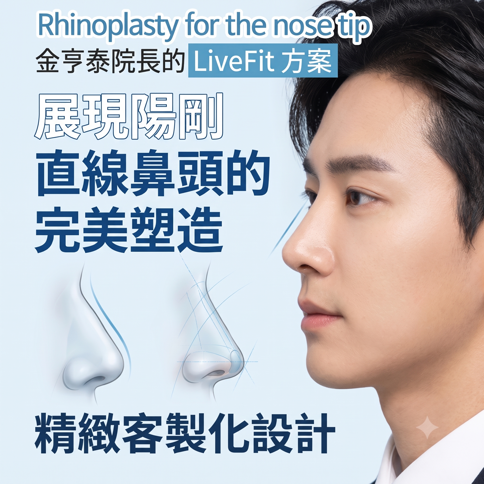 Kowon整形外科以RibFit完成男性鼻尖整形與鼻樑線條矯正