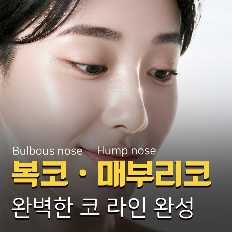 콧대부터 콧날개까지! 자연스러운 실루엣을 만드는 매부리코성형 핵심 포인트