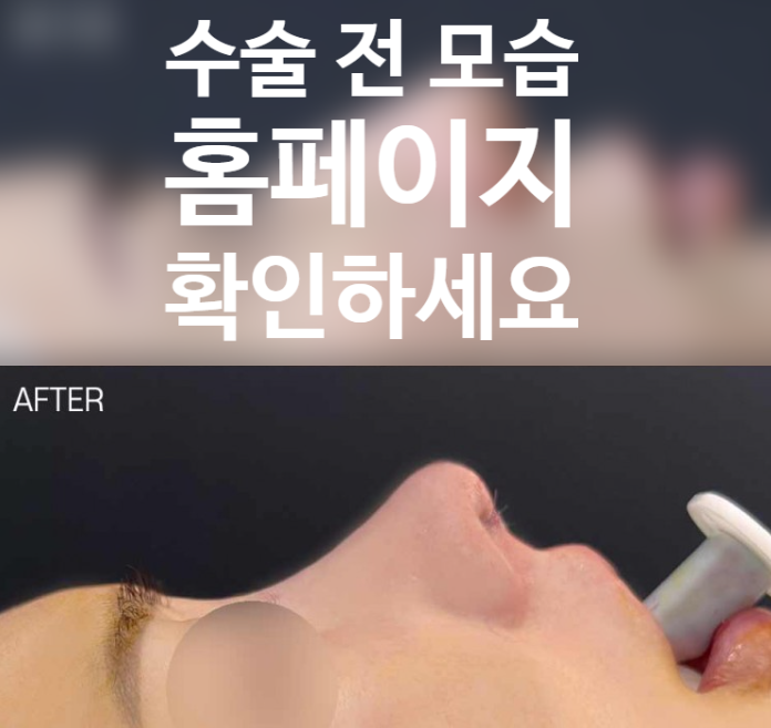 짧은코 성형, 콧대 높이부터 코끝 지지대까지 정교하게 다듬는 코원성형외과 노하우