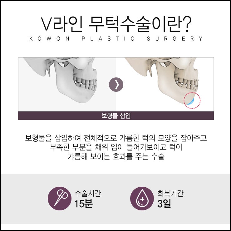 무턱보형물수술, 조화와 자연스러움을 중시하는! 사진 3