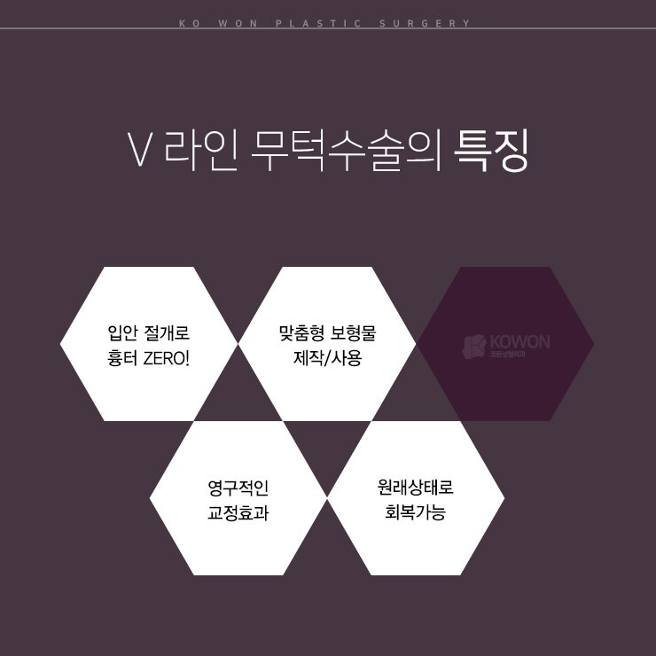 무턱보형물수술, 조화와 자연스러움을 중시하는!