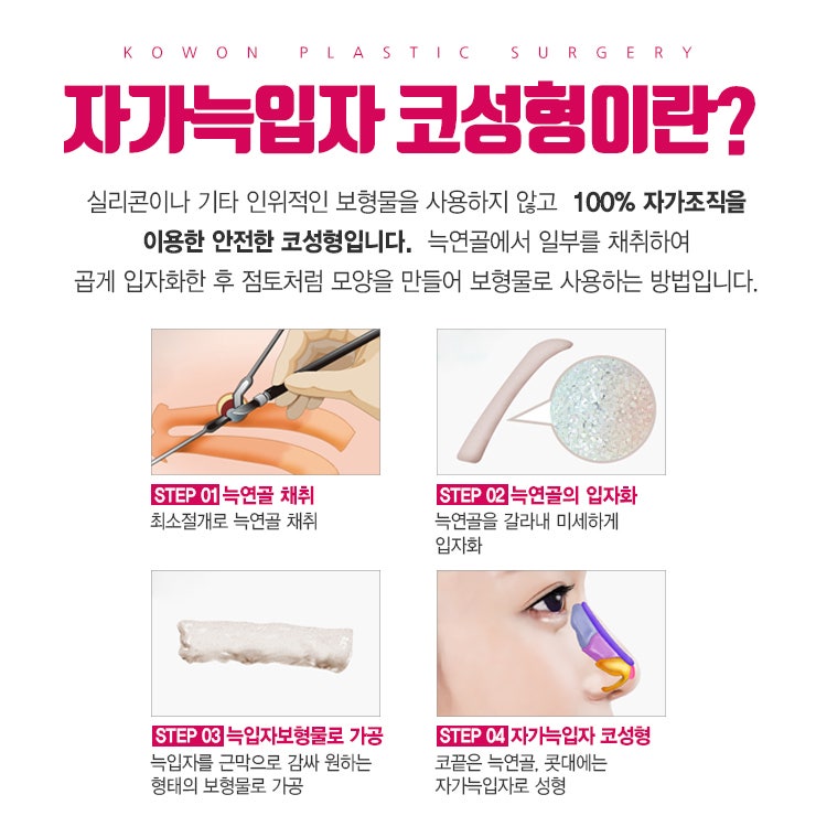부작용이 두렵다면, 자가늑입자코성형에 도전! 사진 27