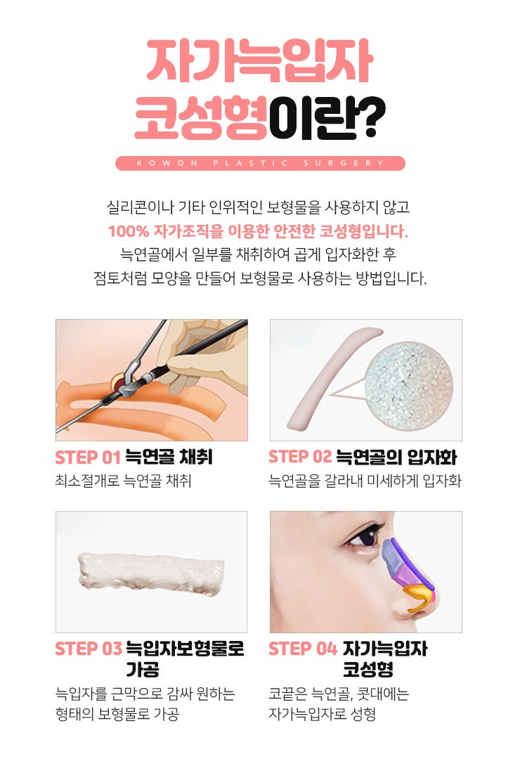 누구나 부러워하는 코 모양의 완성! 자가늑입자코성형! 사진 38