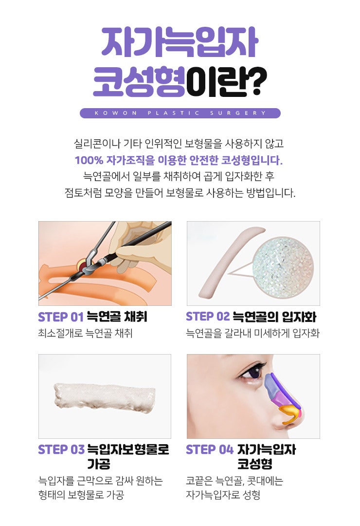 누구나 부러워하는 코 모양의 완성! 자가늑입자코성형! 사진 10